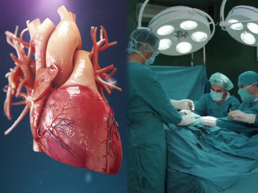 A 58 year old woman has survived a complicated open heart surgery | लढ्याला यश! ५८ वर्षीय महिलेला गुंतागुंतीच्या ‘ओपन हार्ट’ शस्त्रक्रियेनंतर मिळालं जीवदान