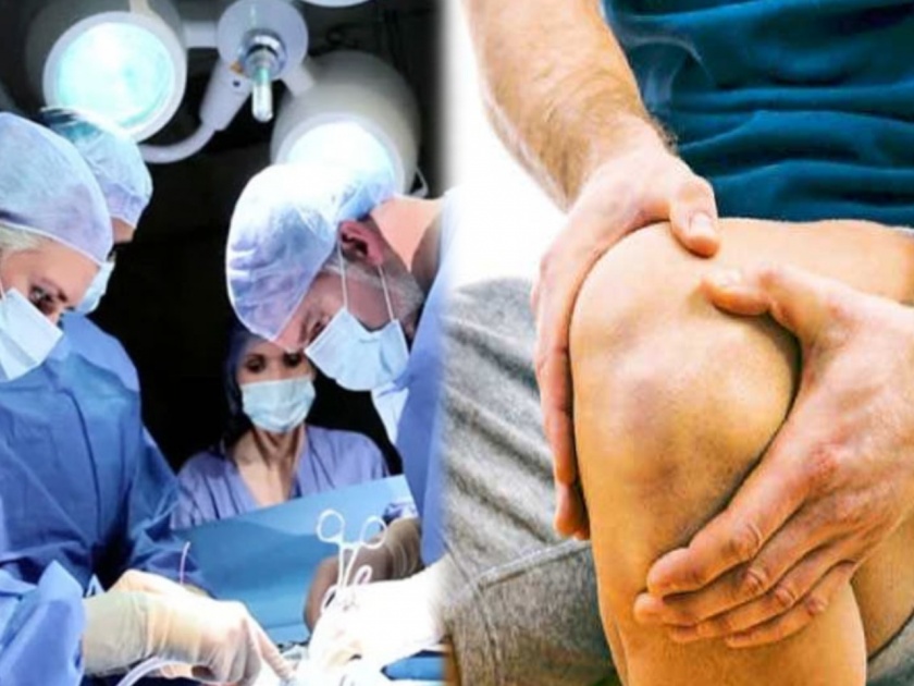 Knee surgery develops a new technique to make it less painful | अरे व्वा! गुडघ्यांवरील शस्त्रक्रिया कमी वेदनादायी होण्यासाठी एक नवीन तंत्र विकसित