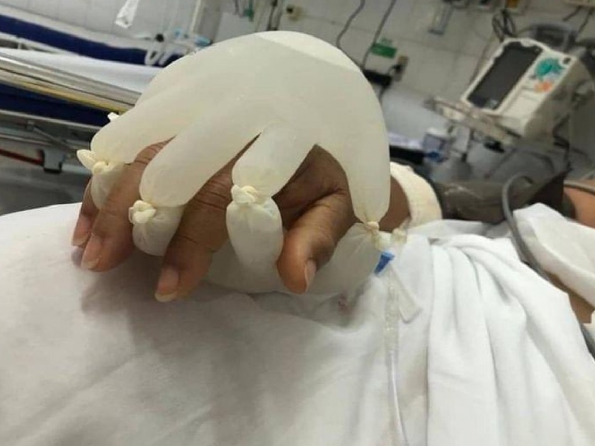 Viral News : Brazil nurse gave artificial human touch pics will touch your heart | कोरोना रुग्णाचा एकटेपणा घालवण्यासाठी; नर्सनं जे केलं ते पाहून तुमच्याही डोळ्यात येईल पाणी....