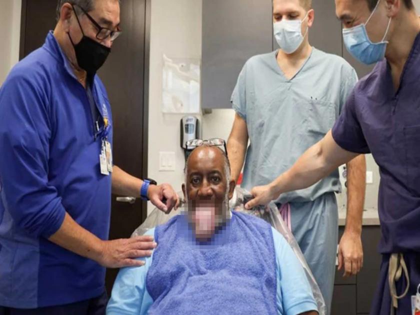 new side effect covid tongue seen in black corona patients making people unable to talk or eat | CoronaVirus News : भयंकर! कोरोनाचा नवा साईड इफेक्ट; आकार वाढून तोंडाबाहेर लटकतेय रुग्णाची जीभ