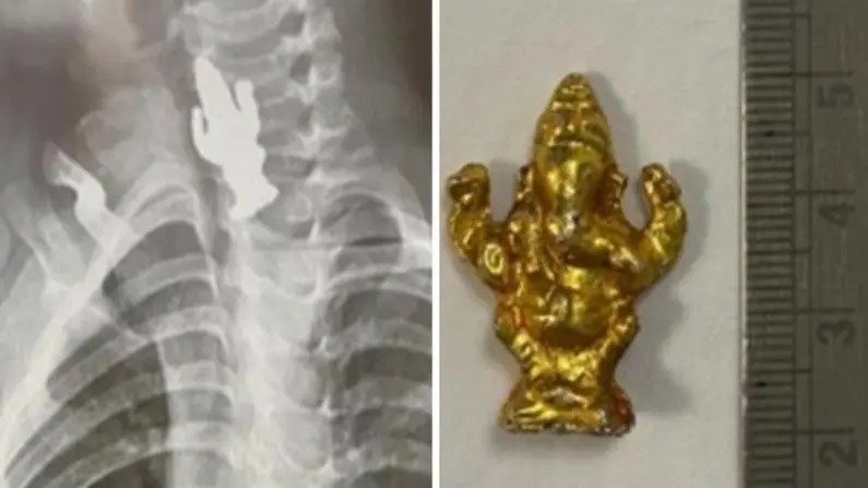 3 year old boy swallows ganesha idol survives after medical treatment in bengaluru | अरे देवा! 3 वर्षीय चिमुकल्याने गिळली गणपतीची मूर्ती, एक्स-रे पाहून डॉक्टरही झाले हैराण अन्...