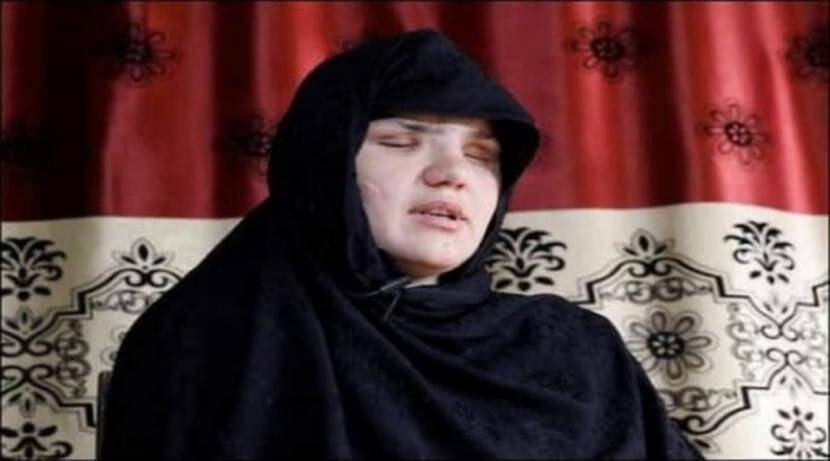 Afghanistan Taliban Crisis taliban kidnapped me shot me in head and took out my eyes says afghan woman | Afghanistan Taliban Crisis : हृदयद्रावक! "तालिबानींनी माझं अपहरण केलं, डोक्यात गोळ्या झाडल्या आणि नंतर काढले डोळे"
