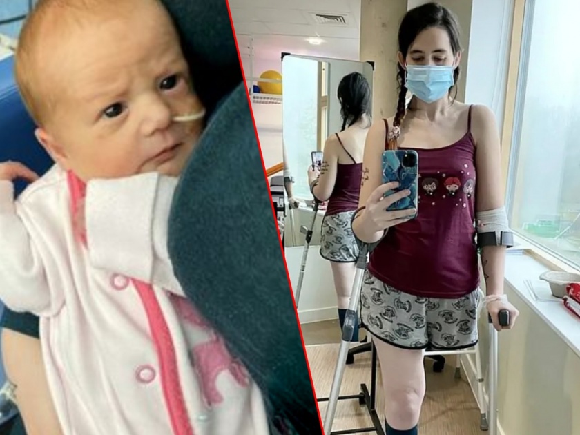 shocking woman cuts her leg to save a baby during pregnancy | थोर तुझी माया! आईनं आपल्या मुलाला वाचवण्यासाठी चक्क पाय कापला, गरोदरपणात घेतला निर्णय