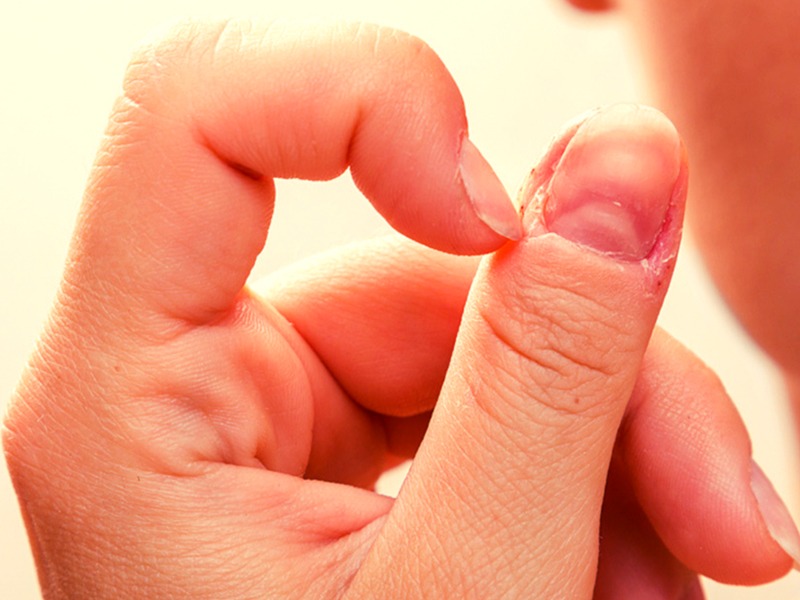 if you have marks in nails then it can be melanoma check yourself it can be cancer risk | तुमची नखं देतात 'या' विशिष्ट दुर्मिळ कॅन्सरचे संकेत, 'ही' चिन्हे असल्यास त्वरित डॉक्टरांना गाठा