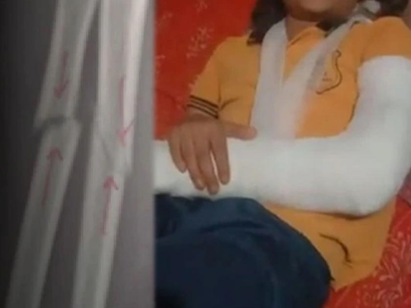 school student 10 year old girl thrashed for not paying school fees teacher broke her hand | संतापजनक! शाळेची फी न भरल्याने 10 वर्षीय मुलीला बेदम मारहाण; शिक्षकाने हातच मोडला अन्...
