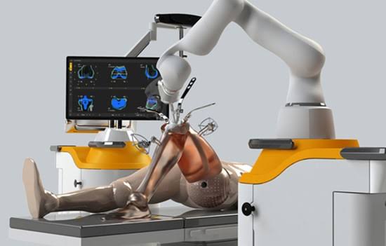 The first robotic joint transplant surgery was performed in Chandrapur | चंद्रपुरात झाली पहिली रोबोटिक जॉइंट प्रत्यारोपण शस्त्रक्रिया