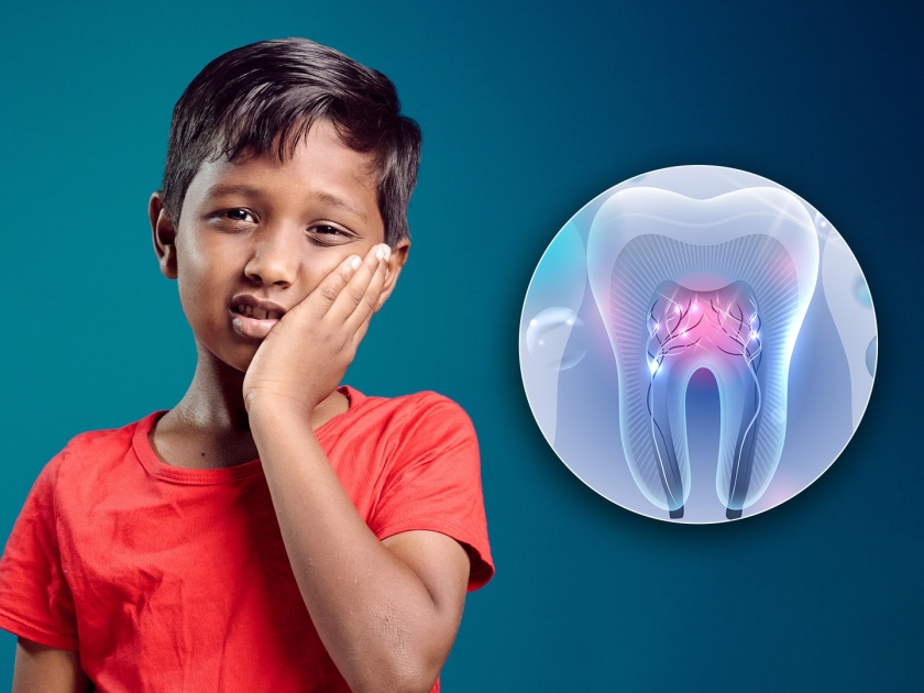 Now dental implants are possible even in children - Initiative of Government Dental College: Introducing an innovative solution called 'Pedoplant' | आता लहान मुलांमध्येही दंत रोपण शक्य - शासकीय दंत महाविद्यालयाचा पुढाकार : ‘पेडोप्लांट’ नावाचा अभिनव उपाय सादर