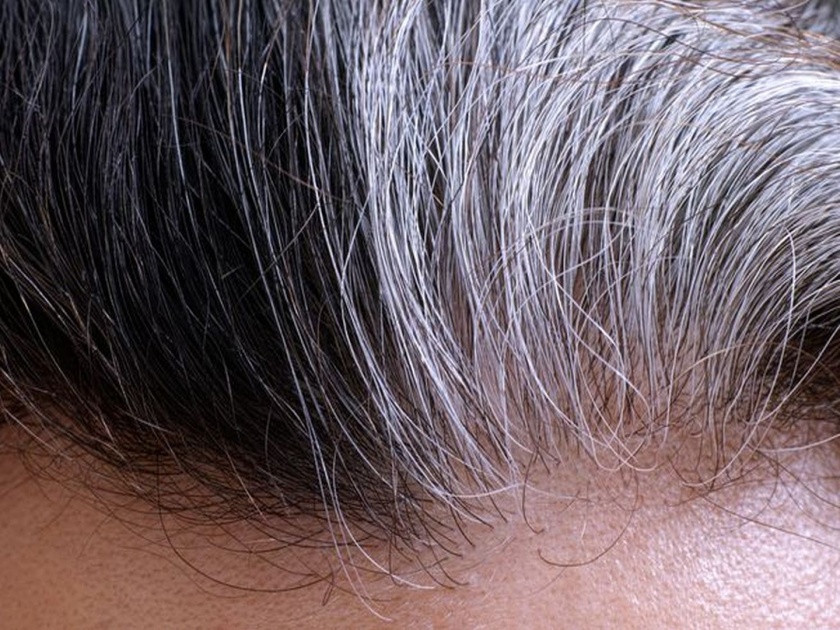 Home remedies for Gray or white hair care in marathi | कमी वयातच पांढरे झालेत केस?; 'या' आजाराचं असू शकतं लक्षणं