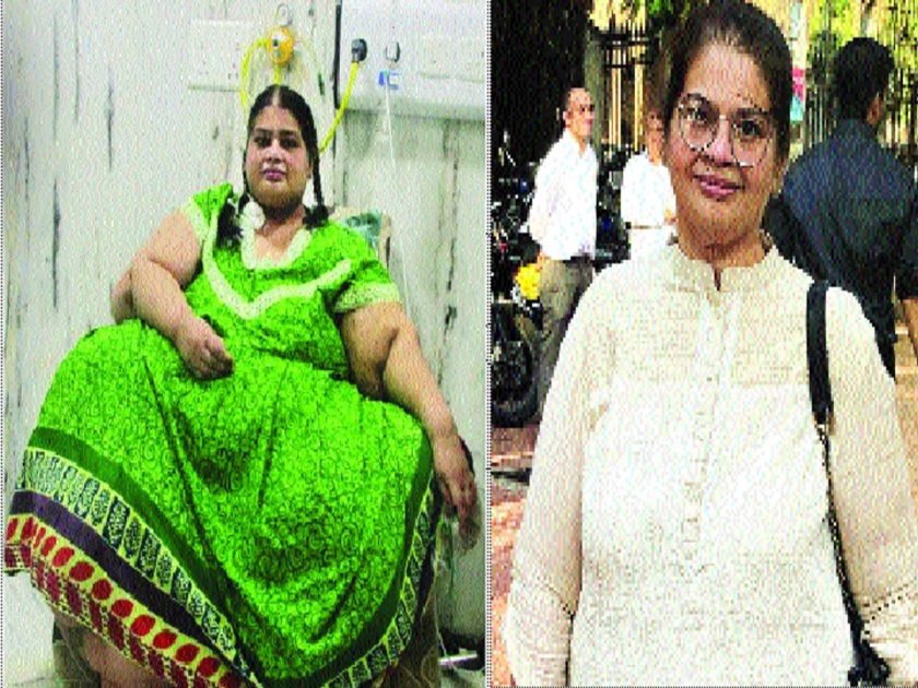 Palghar woman drops 214 kg weight! Treatment begins four years ago | पालघरच्या महिलेने घटवले तब्बल २१४ किलो वजन! चार वर्षे सुरू होते उपचार