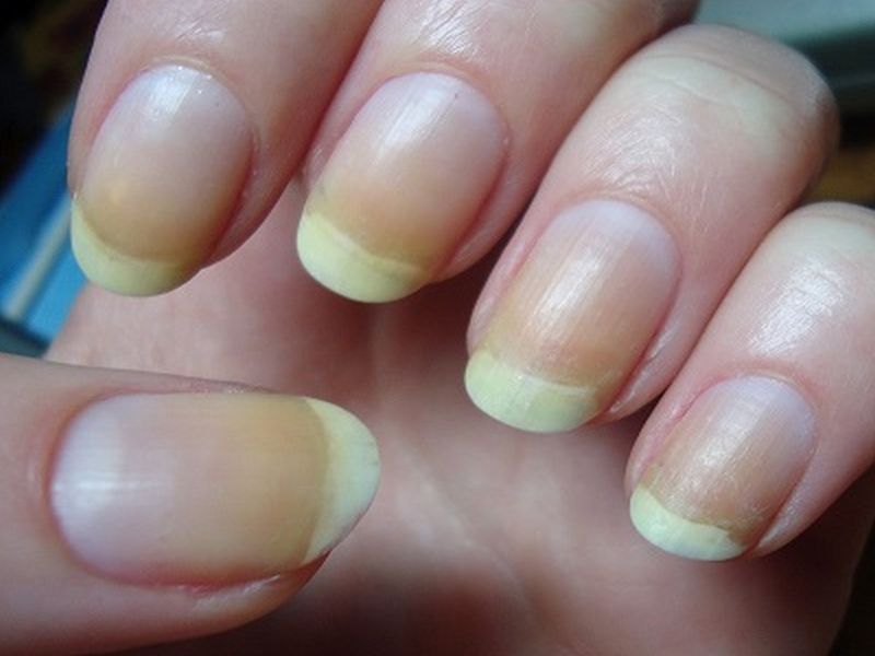 nail care yellow nails scurbing nails | नखं पिवळी पडतायत का? अशी घ्या काळजी!
