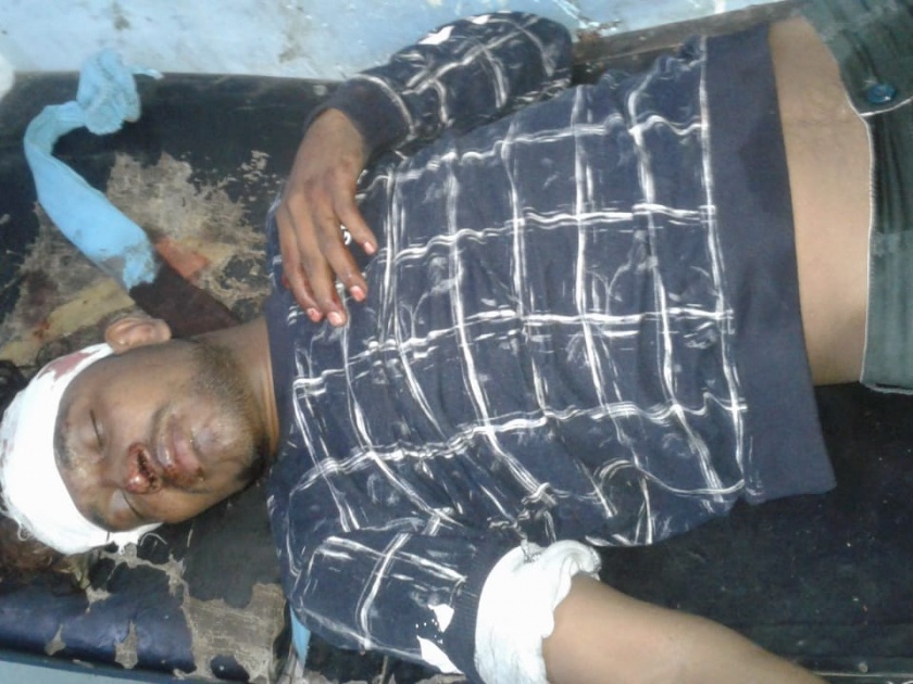 Two youths of Yavatmal district seriously injured after falling by running trains | धावत्या रेल्वेतून पडून यवतमाळ जिल्ह्यातील दोन युवक गंभीर जखमी