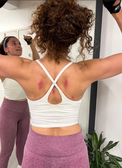 Taapsee Pannu shares glimpse of bruised back after working out on rough ...