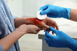 IICT to promote surgical adhesive for rapid wound closure