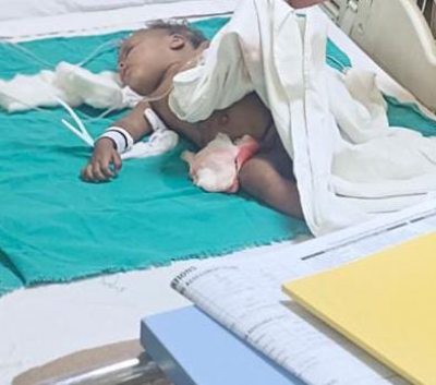 Toddler dies after being attacked by stray dogs in Noida - www ...