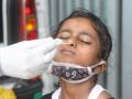 Multisystem Inflammatory Syndrome in TN kids rising - Hindi News | Multisystem Inflammatory Syndrome in TN kids rising | Latest health News at Lokmattimes.com