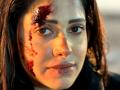 Nushrratt Bharuccha shares 'wounded' picture from 'Akelli' set - Hindi News | Nushrratt Bharuccha shares 'wounded' picture from 'Akelli' set | Latest entertainment News at Lokmattimes.com