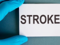 Here’s how silent stroke can dent your brain health - Hindi News | Here’s how silent stroke can dent your brain health | Latest health News at Lokmattimes.com
