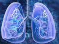 Covid deaths may be linked to a fatal lung disease: Scientists - Hindi News | Covid deaths may be linked to a fatal lung disease: Scientists | Latest health News at Lokmattimes.com