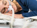 Sleep apnea prevalent in patients at risk of heart failure from cancer therapy - Hindi News | Sleep apnea prevalent in patients at risk of heart failure from cancer therapy | Latest health News at Lokmattimes.com
