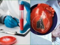 A Simple Blood Test May Predict Heart Attack Risk 6 Months In Advance, Study Suggests - Hindi News | A Simple Blood Test May Predict Heart Attack Risk 6 Months In Advance, Study Suggests | Latest technology News at Lokmattimes.com