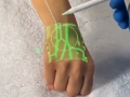 Anand Mahindra shares video of new tech detecting veins using infrared light - Hindi News | Anand Mahindra shares video of new tech detecting veins using infrared light | Latest health News at Lokmattimes.com