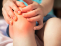Girls more affected by juvenile idiopathic arthritis than boys: Experts - Hindi News | Girls more affected by juvenile idiopathic arthritis than boys: Experts | Latest health News at Lokmattimes.com