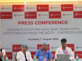 Doctors save baby born with intestines outside body in Gurugram - Hindi News | Doctors save baby born with intestines outside body in Gurugram | Latest health News at Lokmattimes.com