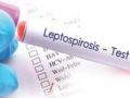 Leptospirosis cases continue to rise in Philippines, breaching 2,000 - Hindi News | Leptospirosis cases continue to rise in Philippines, breaching 2,000 | Latest health News at Lokmattimes.com
