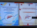 Non-Alcoholic Fatty Liver Disease: Union Health Ministry Releases Comprehensive New Guidelines - Hindi News | Non-Alcoholic Fatty Liver Disease: Union Health Ministry Releases Comprehensive New Guidelines | Latest health News at Lokmattimes.com