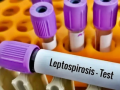 Leptospirosis cases continue to rise in the Philippines - Hindi News | Leptospirosis cases continue to rise in the Philippines | Latest health News at Lokmattimes.com