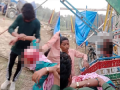 Uttar Pradesh Horror: Teenage Girl’s Scalp Ripped Off in Swing Accident at Kannauj Fair - Hindi News | Uttar Pradesh Horror: Teenage Girl’s Scalp Ripped Off in Swing Accident at Kannauj Fair | Latest national News at Lokmattimes.com