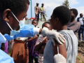 Mpox deaths rise to 10 in Uganda: Health Ministry - Hindi News | Mpox deaths rise to 10 in Uganda: Health Ministry | Latest health News at Lokmattimes.com