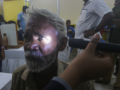 India launches AI-driven community screening for diabetic retinopathy - Hindi News | India launches AI-driven community screening for diabetic retinopathy | Latest health News at Lokmattimes.com