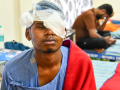 190 suffer firecracker, carbide gun-based eye injuries during Diwali: AIIMS Delhi - Hindi News | 190 suffer firecracker, carbide gun-based eye injuries during Diwali: AIIMS Delhi | Latest health News at Lokmattimes.com