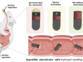 IIT Delhi, AIIMS’s new ingestible device can collect microbial samples from small intestine - Hindi News | IIT Delhi, AIIMS’s new ingestible device can collect microbial samples from small intestine | Latest health News at Lokmattimes.com