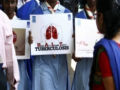 Gujarat: Gir Somnath emerges as model district in TB elimination drive​ - Hindi News | Gujarat: Gir Somnath emerges as model district in TB elimination drive​ | Latest national News at Lokmattimes.com