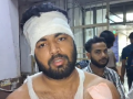 Addicts attack family in Delhi's Sonia Vihar with knives, rods after complaint over drug use near house; three injured - Hindi News | Addicts attack family in Delhi's Sonia Vihar with knives, rods after complaint over drug use near house; three injured | Latest national News at Lokmattimes.com