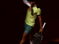 Alcaraz awaits key wrist tests ahead of French Open, says ‘need to recover really well’ - Hindi News | Alcaraz awaits key wrist tests ahead of French Open, says ‘need to recover really well’ | Latest other-sports News at Lokmattimes.com