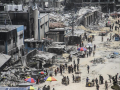 Humanitarians warn of lack of prosthetic care in Gaza - Hindi News | Humanitarians warn of lack of prosthetic care in Gaza | Latest international News at Lokmattimes.com