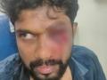 Congress alleges attack on LoP by CPI-M activists in Kerala - Hindi News | Congress alleges attack on LoP by CPI-M activists in Kerala | Latest politics News at Lokmattimes.com