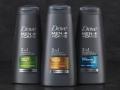 5 tips men can head to take care of an oily scalp in summer - Hindi News | 5 tips men can head to take care of an oily scalp in summer | Latest lifestyle News at Lokmattimes.com