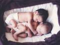 Twins born prematurely at 24 weeks brave hernia, heart defect to survive - Hindi News | Twins born prematurely at 24 weeks brave hernia, heart defect to survive | Latest health News at Lokmattimes.com