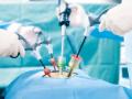 AI tool to help make real-time diagnoses during surgery: Study - Hindi News | AI tool to help make real-time diagnoses during surgery: Study | Latest health News at Lokmattimes.com