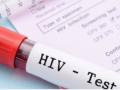 Global HIV market to cross $32 billion in 7 major markets in 2033: Report - Hindi News | Global HIV market to cross $32 billion in 7 major markets in 2033: Report | Latest health News at Lokmattimes.com