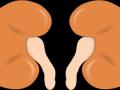 Sodium-potassium level imbalance can pose adverse health risks in kidneys, experts say - Hindi News | Sodium-potassium level imbalance can pose adverse health risks in kidneys, experts say | Latest health News at Lokmattimes.com