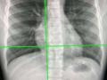 AI-powered X-rays can tell true age by looking at chest - Hindi News | AI-powered X-rays can tell true age by looking at chest | Latest international News at Lokmattimes.com