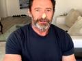 Hugh Jackman reveals new skin cancer scare as he makes public plea - Hindi News | Hugh Jackman reveals new skin cancer scare as he makes public plea | Latest entertainment News at Lokmattimes.com
