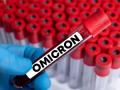 Omicron variant did not eliminate Delta, it may return: Study - Hindi News | Omicron variant did not eliminate Delta, it may return: Study | Latest health News at Lokmattimes.com