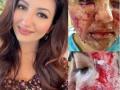 Indian-American Miss World 2021 first runner-up lives with pacemaker, survived facial burns - Hindi News | Indian-American Miss World 2021 first runner-up lives with pacemaker, survived facial burns | Latest national News at Lokmattimes.com