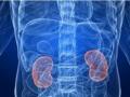 Can low-dose lithium help improve kidney health? - Hindi News | Can low-dose lithium help improve kidney health? | Latest health News at Lokmattimes.com